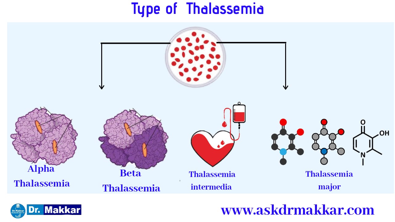 thalassemia-causes-symptoms-best-homeopathic-medicine-no-need-of-blood-transfusion